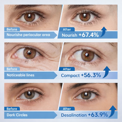 Bio-Collagen Real Deep Eye Patches